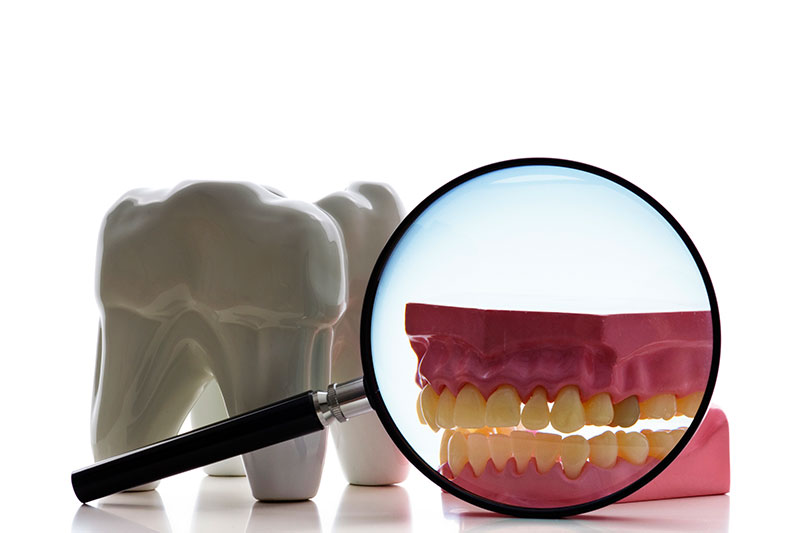 Root Canal in Ontario
